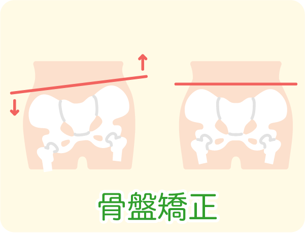 産後骨盤矯正
